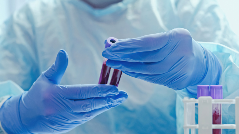 Photo shows a medical worker examining blood samples in a lab/Getty Images