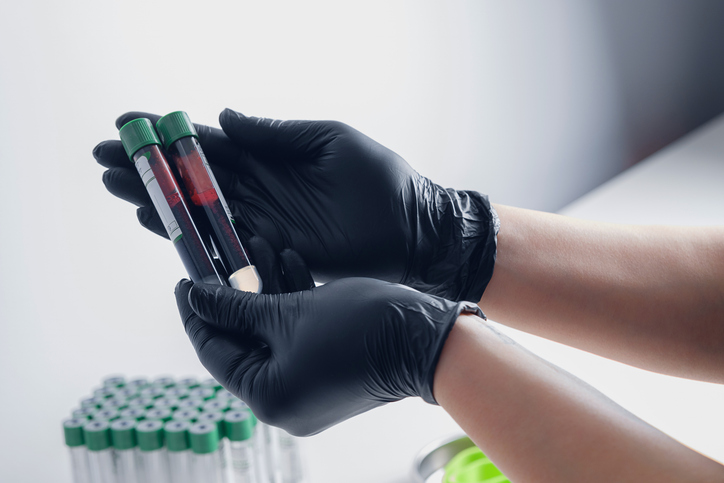 Photo shows a medical worker holding two blood samples/Getty Images