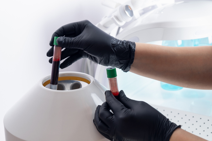 Photo shows a medical worker placing a test tube with blood in a centrifuge to separate plasma from blood./Getty Images