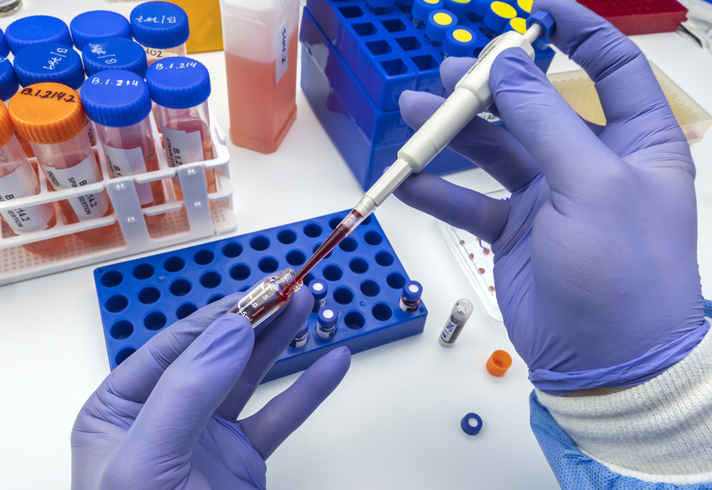 Photo shows researcher conducting a blood analysis/Getty Images