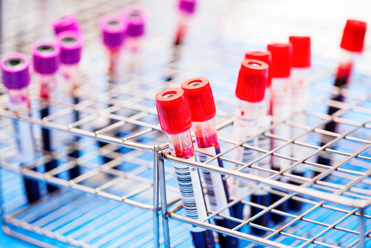 Photo shows vials of blood in a lab/Getty Images