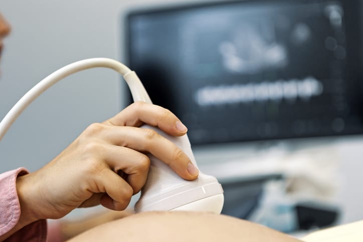 Phot shows a doctor performing an ultrasound on a pregnant woman/Getty Images