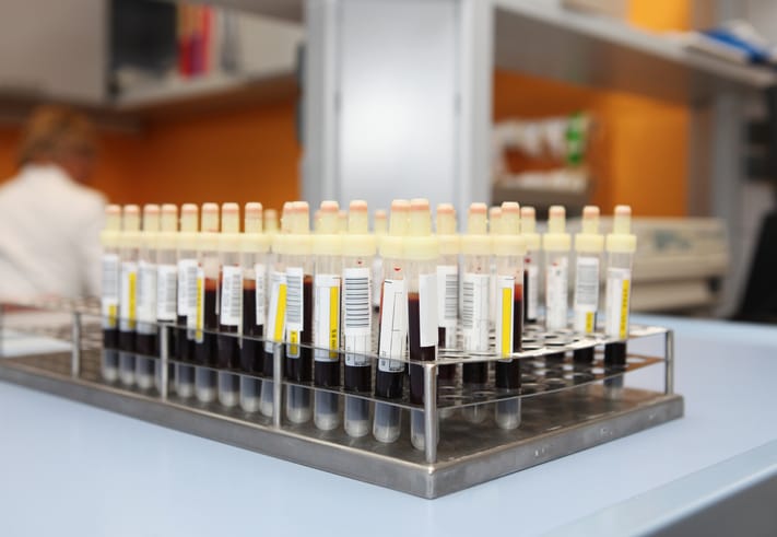 Photo shows blood samples for blood type testing in test tubes in a lab/Getty Images