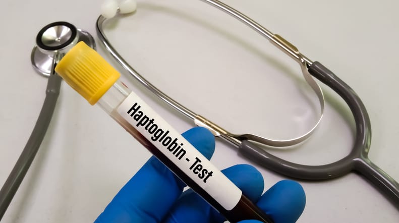 Photo shows a blood sample tube for a haptoglobin test/Getty Images