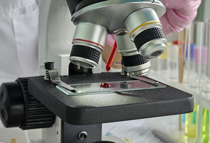 Photo shows a microscope with a blood sample in a laboratory/Getty Images