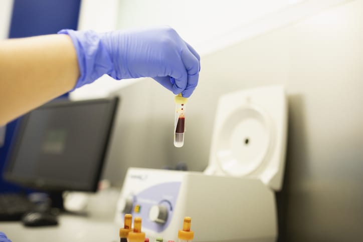 Photo shows a researcher holding a blood sample in a lab/Getty Images