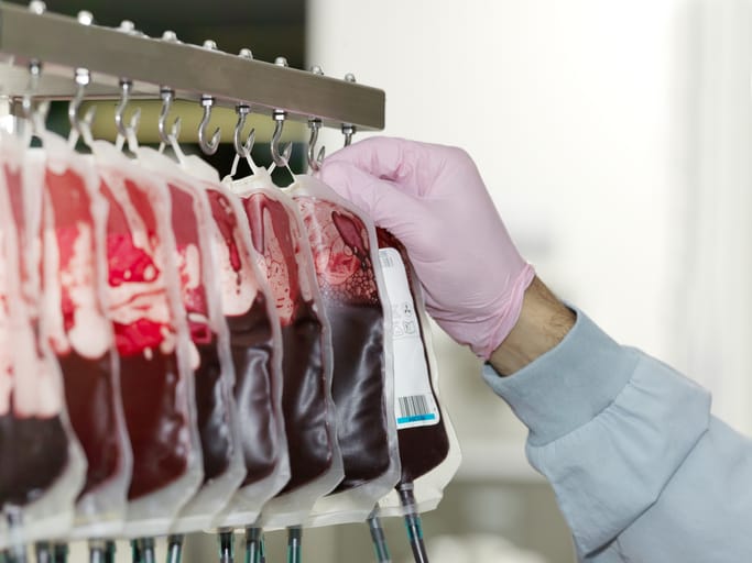 Photo shows bags of donated blood hanging in processing facility of blood bank/Getty Images