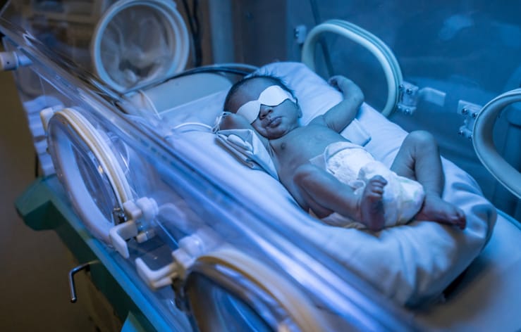 Photo shows a newborn in an incubator with jaundice being treated via phototherapy/Getty Images